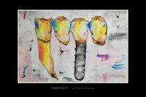 implants 01 by Michael Leinsinger