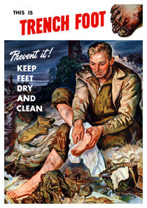 This Is Trench Foot -- Prevent It! by warishellstore
