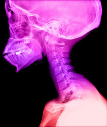  Human Skull and Cervical Spine Human Skull and Cervical Spine von sciencesource