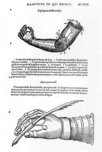 Description of a mechanical iron arm and hand von French School