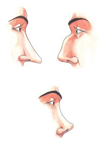Body parts: noses by William Rossin