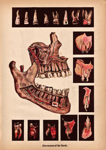 Diseases of the teeth von Mark Strozier