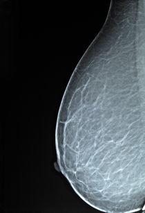 Mammograms X-ray by Sami Sarkis Photography