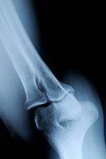 X-ray image of mature's man elbow von Sami Sarkis Photography