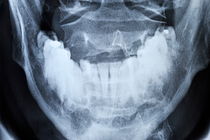 X-ray of healthy mature man's jawbone by Sami Sarkis Photography