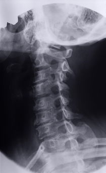 Cervical vertebra and head X-ray by Sami Sarkis Photography