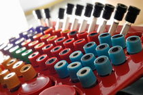 Tubes in a nurse medical suitcase by Sami Sarkis Photography