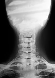 Cervical vertebra and head X-ray von Sami Sarkis Photography